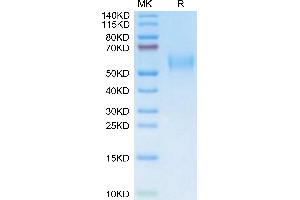 Plasminogen Activator, Urokinase Receptor (PLAUR) (AA 24-298) protein (His-Avi Tag)