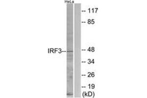Western blot analysis of extracts from HeLa cells, using IRF3 (Ab-396) Antibody. (IRF3 抗体  (AA 362-411))