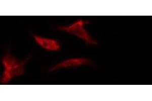 ABIN6276034 staining LOVO by IF/ICC. (GPR34 抗体  (C-Term))