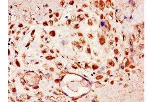 Immunohistochemistry of paraffin-embedded human placenta tissue using ABIN7151436 at dilution of 1:100 (FBLN4 抗体  (AA 26-165))