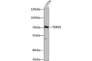 Western blot analysis of extracts of U2OS cells, using TDRD3 antibody (ABIN6133097, ABIN6148978, ABIN6148979 and ABIN6221657) at 1:1000 dilution. (TDRD3 抗体  (AA 1-220))