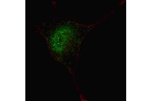 Fluorescent confocal image of SY5Y cells stained with phospho-STAT3- antibody. (STAT3 抗体  (pSer727))