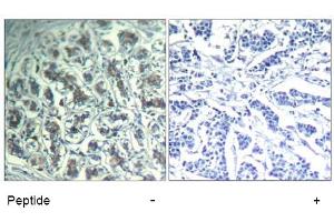 Image no. 1 for anti-phospholipase C, gamma 1 (PLCG1) (Tyr771) antibody (ABIN319399) (Phospholipase C gamma 1 抗体  (Tyr771))