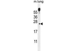 Western Blotting (WB) image for anti-Vesicular, Overexpressed in Cancer, Prosurvival Protein 1 (VOPP1) antibody (ABIN2996076) (VOPP1 抗体)