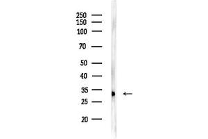 anti-Odd-Skipped Related 1 (OSR1) (C-Term) antibody