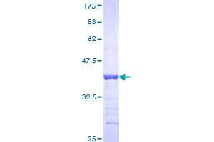 Image no. 1 for Fibroblast Growth Factor 9 (FGF-9) (AA 99-208) protein (GST tag) (ABIN1354023)