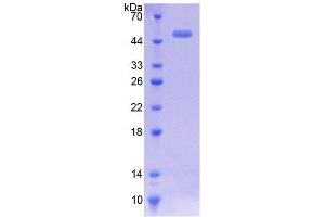SDS-PAGE analysis of Mouse CACNa1H Protein. (CACNA1H 蛋白)