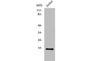 Western Blot analysis of MCF7 cells using Neuromedin-S Polyclonal Antibody (NMS 抗体  (C-Term))
