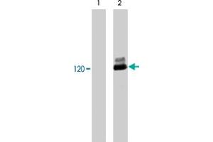 Western blot analysis of human Jurkat cells untreated (lane 1) or treated with pervanadate (1 mM) for 30 minutes (lane 2). (CBL 抗体  (pTyr700))