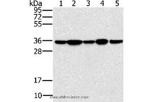 Western blot analysis of Jurkat, 293T and hela cell, mouse brain tissue and K562 cell, using PPP1CC Polyclonal Antibody at dilution of 1:200 (PPP1CC 抗体)
