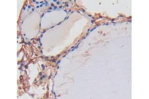 IHC-P analysis of thyroid tissue, with DAB staining.
