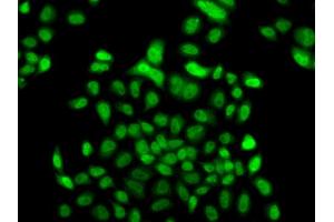 Immunofluorescence analysis of A549 cell using FBXO7 antibody. (FBXO7 抗体)