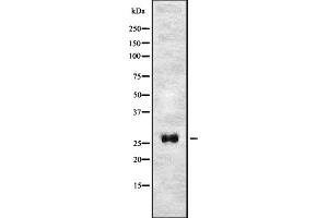 Western blot analysis of T106C expression in HEK293 cells ,The lane on the left is treated with the antigen-specific peptide. (TMEM106C 抗体  (Internal Region))