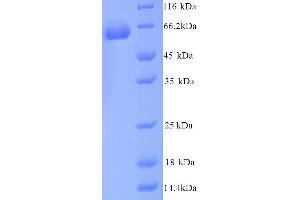 Glucose-6-Phosphate Isomerase (G6PI) (AA 2-558) protein (His tag)