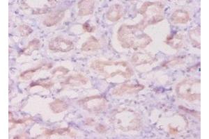 Immunohistochemistry of paraffin-embedded human kidney tissue using ABIN7145472 at dilution of 1:50 (beta Defensin 1 抗体  (AA 33-68))