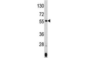 Western blot analysis of ANGPTL3 antibody and mouse liver tissue lysate. (ANGPTL3 抗体  (AA 82-114))