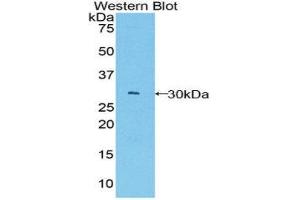 Western Blotting (WB) image for anti-B-Cell CLL/lymphoma 3 (BCL3) (AA 127-376) antibody (ABIN1858125) (BCL3 抗体  (AA 127-376))