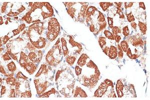 Immunohistochemistry of paraffin-embedded Human stomach using KIF2C Polyclonal Antibody at dilution of 1:100 (40x lens).