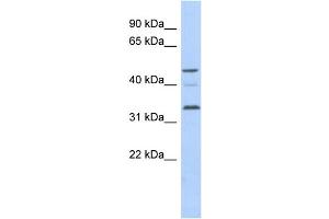 WB Suggested Anti-CCNYL1 Antibody Titration: 0. (CCNYL1 抗体  (N-Term))
