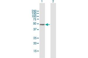 Western Blot analysis of FOXD4L1 expression in transfected 293T cell line by FOXD4L1 MaxPab polyclonal antibody. (FOXD4L1 抗体  (AA 1-408))