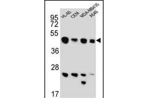 BIN2 Antibody (N-term) (ABIN651965 and ABIN2840476) western blot analysis in HL-60,CEM,MDA-M,A549 cell line lysates (15 μg/lane). (BIN2 抗体  (N-Term))