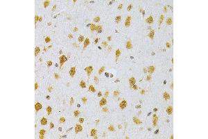 Immunohistochemistry of paraffin-embedded mouse brain using MDM2 Antibody  at dilution of 1:200 (40x lens). (MDM2 抗体  (AA 130-230))