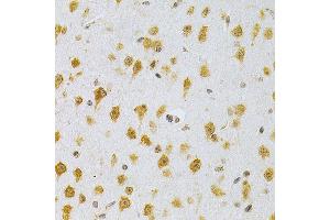 Immunohistochemistry of paraffin-embedded mouse brain using MDM2 Antibody  at dilution of 1:200 (40x lens).