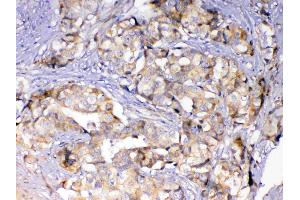 IHC analysis of Adenylosuccinate Lyase using anti-Adenylosuccinate Lyase antibody . (ASL 抗体)
