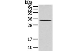 Western Blot analysis of Mouse liver tissue using UCP2 Polyclonal Antibody at dilution of 1/200 (UCP2 抗体)