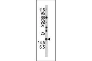 Western blot analysis of anti-Alpha-synuclein Pab (ABIN390368 and ABIN2840773) in mouse brain tissue lysate. (SNCA 抗体  (C-Term))