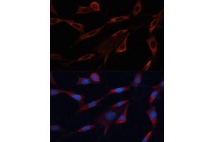 Immunofluorescence analysis of NIH/3T3 cells using Src antibody (ABIN6132240, ABIN6148428, ABIN6148429 and ABIN6215399) at dilution of 1:100. (Src 抗体  (AA 1-80))