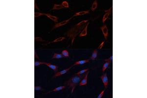 Immunofluorescence analysis of NIH/3T3 cells using Src antibody (ABIN6132240, ABIN6148428, ABIN6148429 and ABIN6215399) at dilution of 1:100.