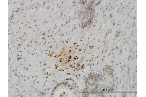 Immunoperoxidase of monoclonal antibody to KISS1 on formalin-fixed paraffin-embedded human prostate. (KISS1 抗体  (AA 46-145))
