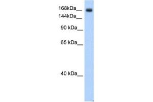 Western Blotting (WB) image for anti-Sodium Channel, Voltage-Gated, Type V, alpha Subunit (SCN5A) antibody (ABIN2461170) (SCN5A 抗体)