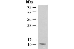 Western blot analysis of Mouse kidney tissue lysate using PCBD1 Polyclonal Antibody at dilution of 1:800 (PCBD1 抗体)
