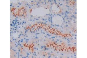 Immunohistochemistry (IHC) image for anti-Prostaglandin E Receptor 1 (Subtype EP1), 42kDa (PTGER1) (AA 23-184) antibody (ABIN5014166)