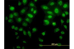 Immunofluorescence of monoclonal antibody to SNAI2 on HeLa cell. (SLUG 抗体  (AA 97-169))