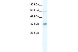 WB Suggested Anti-GJB1 Antibody Titration:  2. (GJB1 抗体  (C-Term))