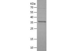 Western Blotting (WB) image for Protein tyrosine Phosphatase, Receptor Type, S (PTPRS) (AA 1058-1207) protein (His-IF2DI Tag) (ABIN7124689)