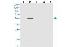Western blot analysis of Lane 1: RT-4, Lane 2: U-251 MG, Lane 3: Human Plasma, Lane 4: Liver, Lane 5: Tonsil with TYSND1 polyclonal antibody .
