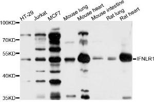 Western Blotting (WB) image for anti-Interleukin 28 Receptor, alpha (Interferon, lambda Receptor) (IL28RA) antibody (ABIN4904012)