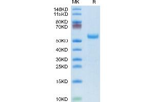 SDS-PAGE (SDS) image for delta Like Protein 3 (DLL3) (AA 27-490) protein (His tag) (ABIN7274489)