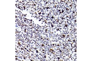 Immunohistochemistry (IHC) image for anti-Minichromosome Maintenance Complex Component 2 (MCM2) antibody (ABIN7268538)