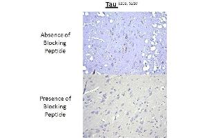 Immunohistochemistry analysis of a competition assay demonstrating the specificity of the anti-Tau (Ser 208/210) antibody