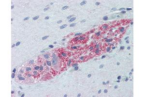 Anti-RPS6KB1 / S6K antibody IHC of human small intestine, myenteric plexus.