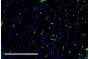 Immunohistochemistry analysis using Mouse Anti-VPS35 Monoclonal Antibody, Clone 8A3 (ABIN6932977). (VPS35 抗体  (PerCP))