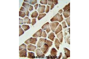 Immunohistochemistry (Paraffin-embedded Sections) (IHC (p)) image for anti-ATP Synthase Subunit gamma (AtpC) (AA 46-76), (N-Term), (Subunit gamma) antibody (ABIN950558)