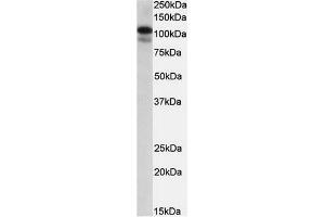 AP23696PU-N SATB1 Antibody staining of MOLT4 lysate at 0. (SATB1 抗体  (Internal Region))
