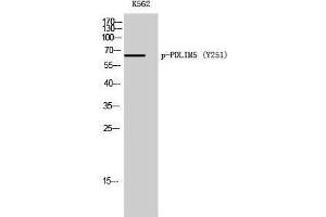 Western Blotting (WB) image for anti-PDZ and LIM Domain 5 (PDLIM5) (pTyr251) antibody (ABIN3182122) (PDLIM5 抗体  (pTyr251))