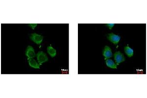 ICC/IF Image RhoC antibody detects RHOC protein at cytoplasm by immunofluorescent analysis. (RHOC 抗体)